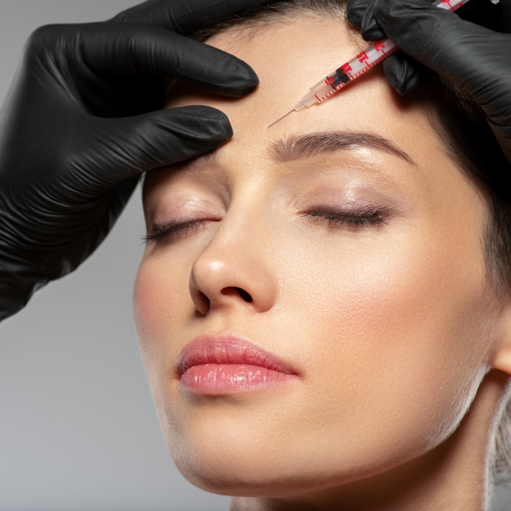Radiesse Volumizing Treatment