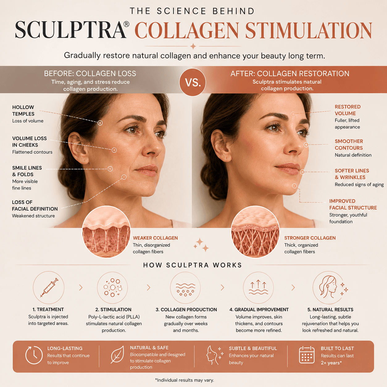 How Sculptra collagen stimulation works for facial rejuvenation and natural collagen restoration in NYC aesthetic treatments